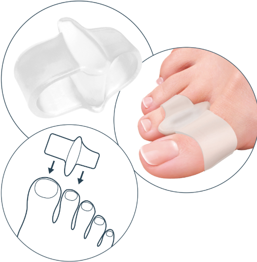 DIVARICATORE PER ALLUCE A DOPPIO ANELLO TECNIWORK